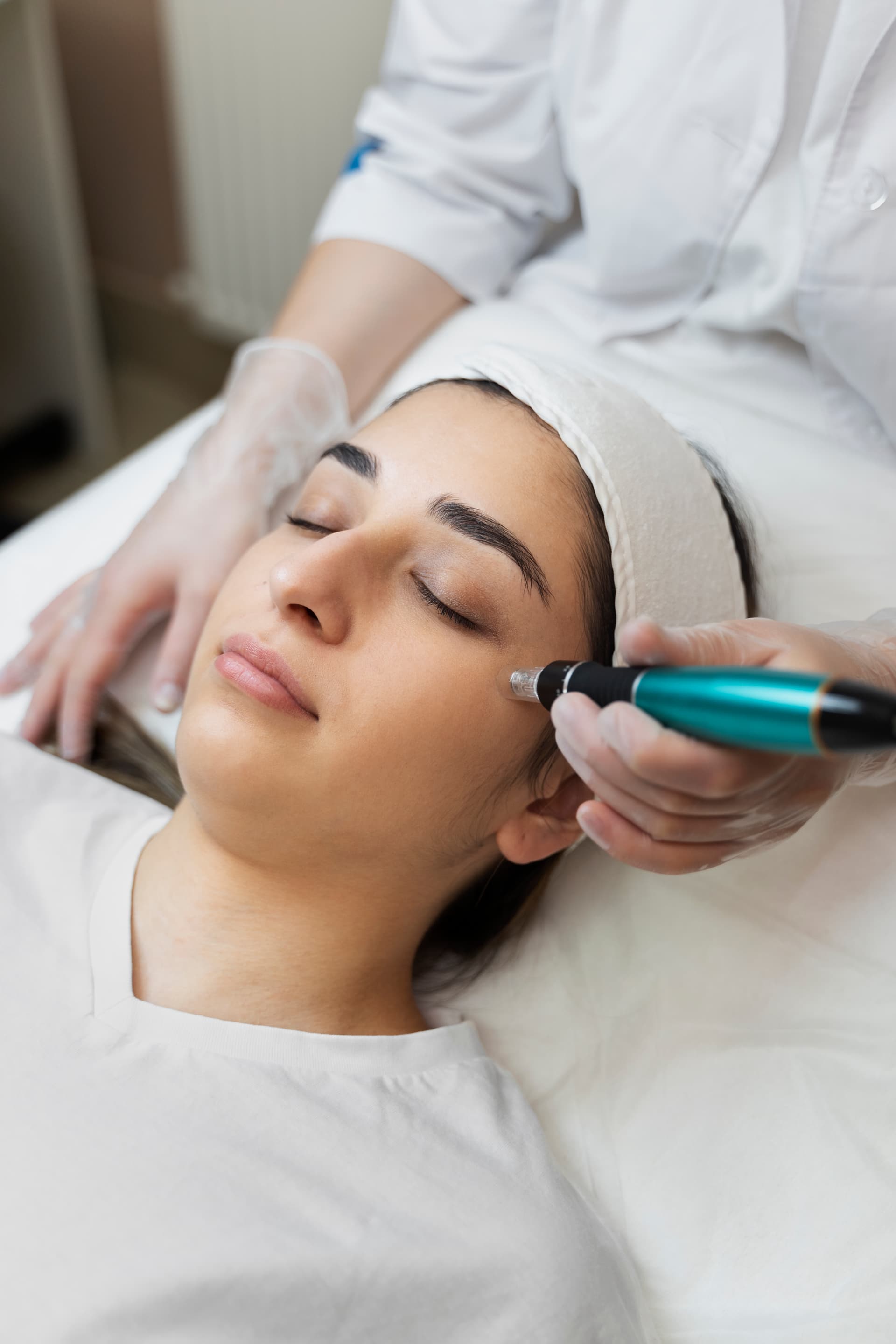 Microneedling beauty treatment session