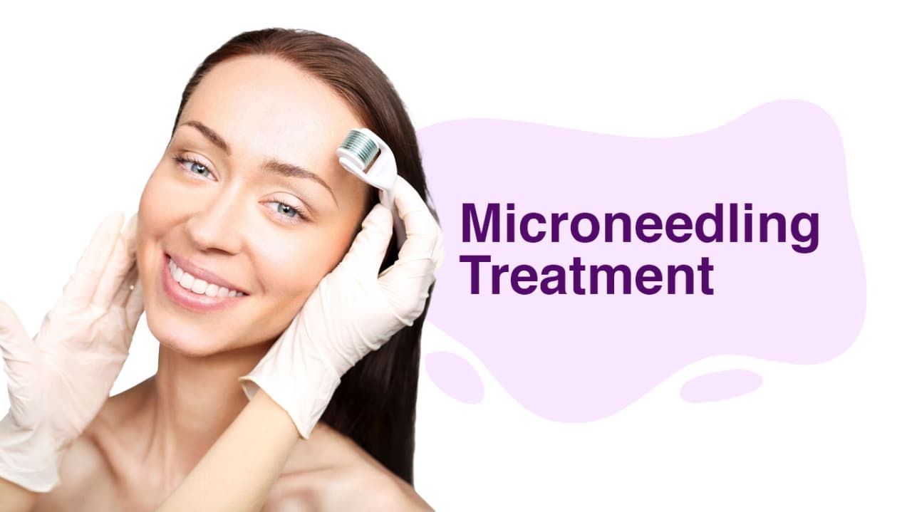 Microneedling beauty treatment session