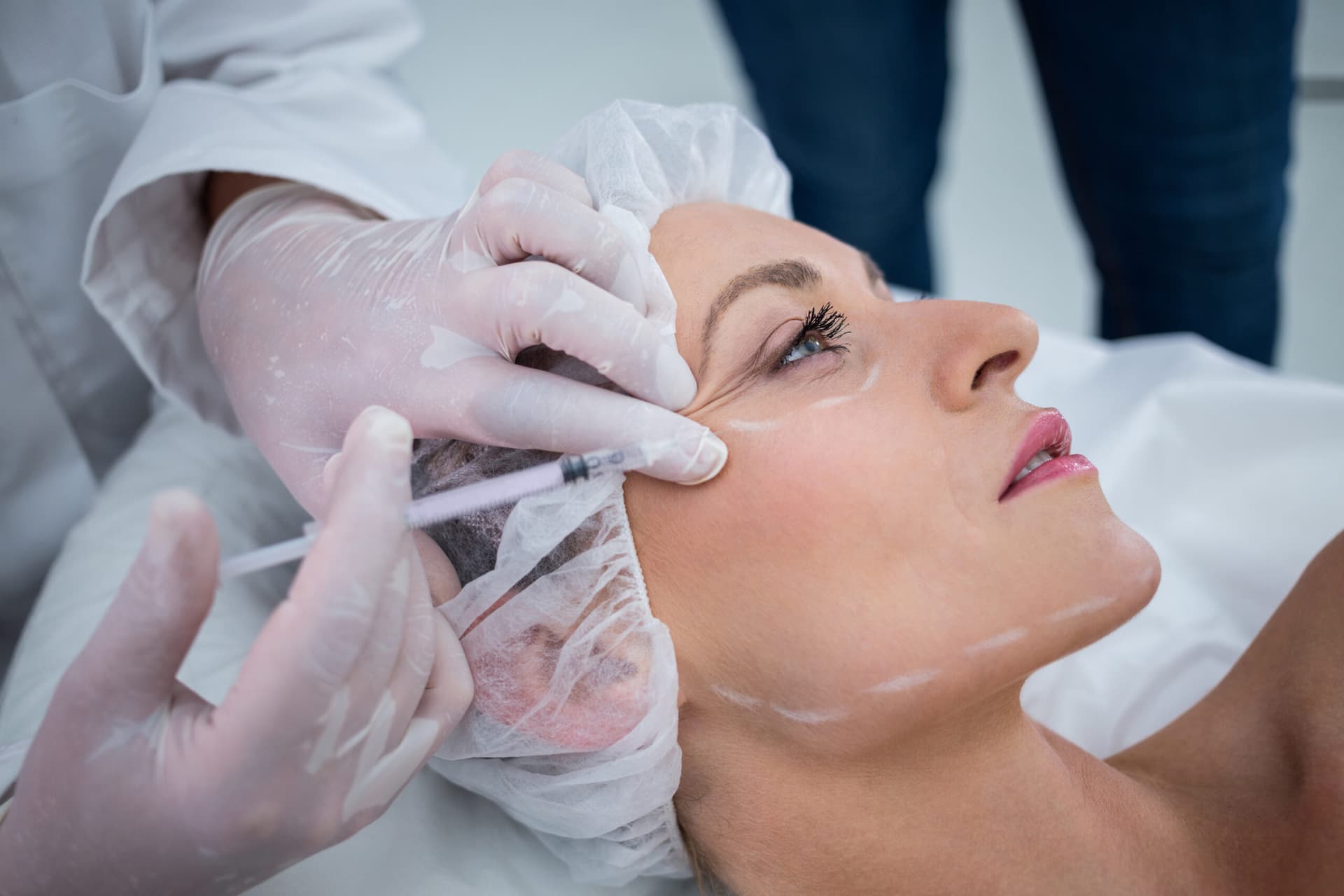 Thread lift aesthetic treatment at AJ Skin Clinic