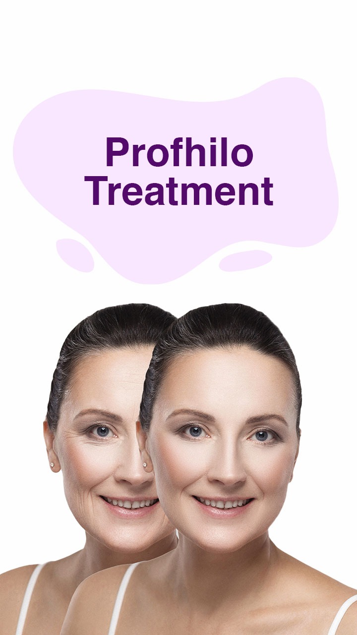 Profhilo Treatment